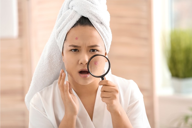 Mulher preocupada com possibilidade de foliculite no rosto, segurando uma lupa enquanto observa as lesões na pele, com uma toalha enrolada no cabelo após o banho.