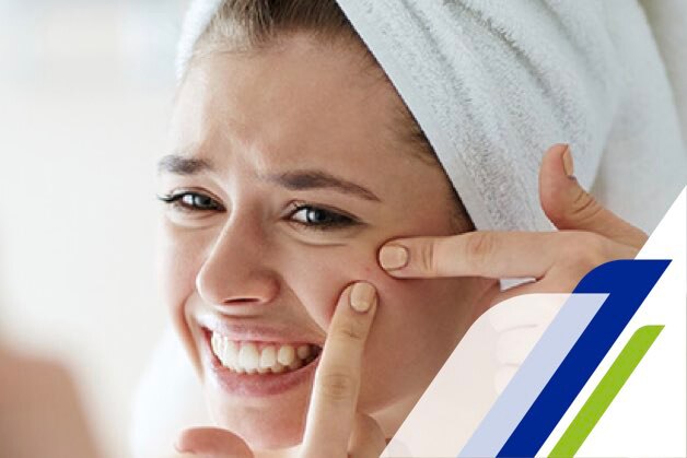 Acnes em adultos Acnes em adultos