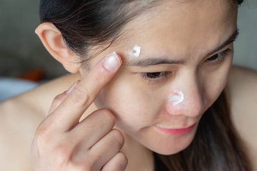 Mulher passando creme na acne do rosto Mulher passando creme na acne do rosto
